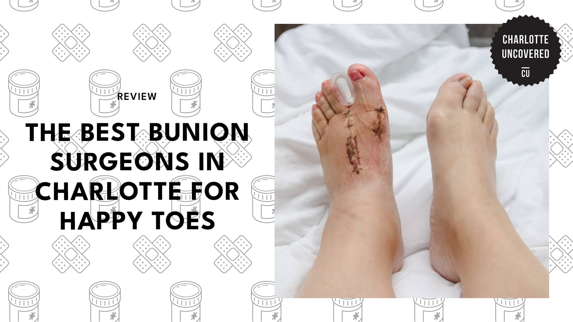 bunion-surgery-charlotte