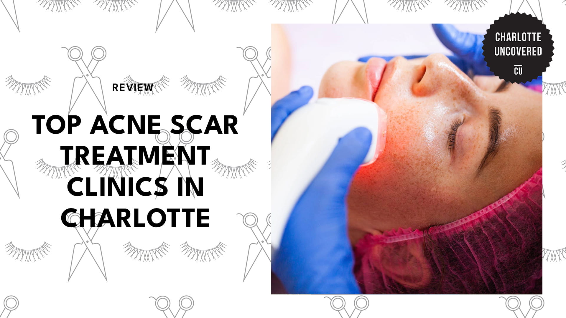 acne-scar-treatment-charlotte-banner
