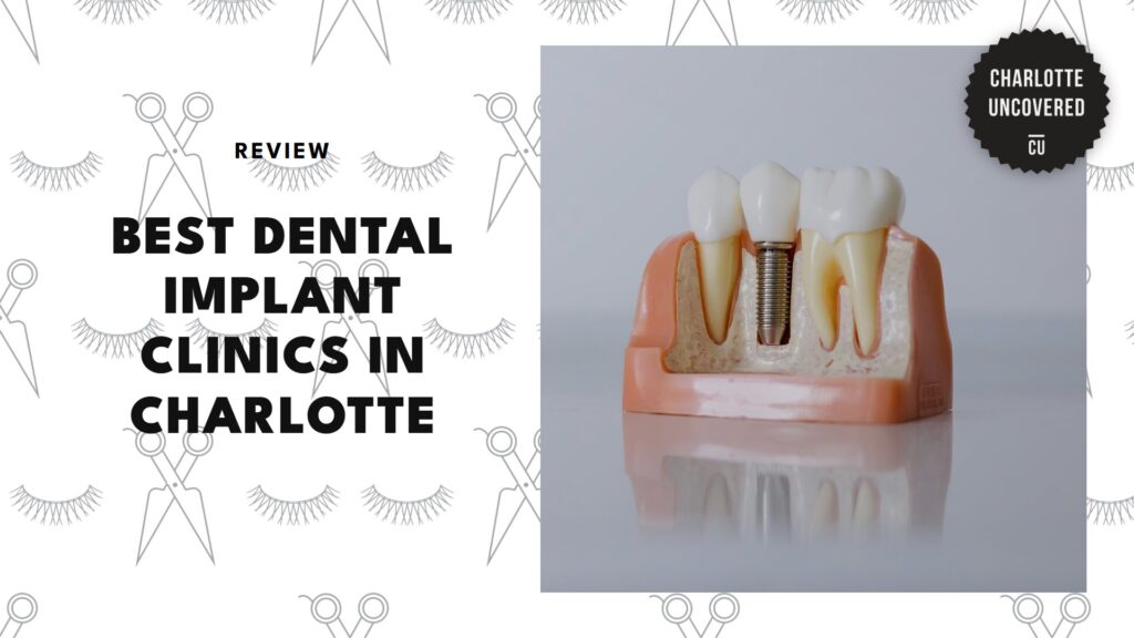 The 5 Best Dental Implant Clinics in Charlotte for Lasting Solutions