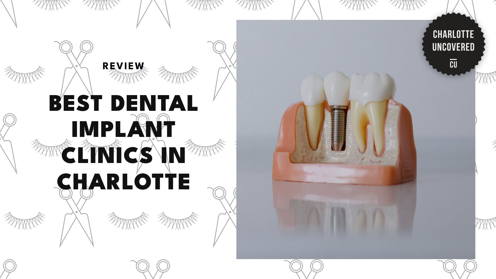 best-dental-implants-charlotte-banner